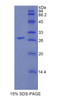 Human Recombinant Interleukin 1 Receptor Associated Kinase 1 (IRAK1)