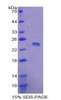 Human Recombinant Serum Amyloid P Component (SAP)