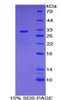 Mouse Recombinant Cytochrome P450 21B (CYP21B)