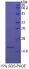 Cattle Recombinant Fatty Acid Binding Protein 1, Liver (FABP1)