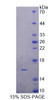 Pig Recombinant Fatty Acid Binding Protein 1, Liver (FABP1)