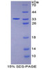 Human Recombinant Signal Transducing Adaptor Molecule 1 (STAM1)