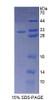 Human Recombinant Palladin (PALLD)