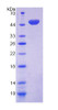 Human Recombinant Cluster Of Differentiation 164 (CD164)