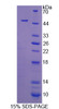 Human Recombinant Cytohesin 4 (CYTH4)