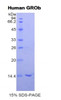 Human Recombinant Growth Regulated Oncogene Beta (GROb)