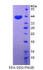 Human Recombinant Growth Regulated Oncogene Gamma (GROg)