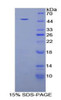 Rat Recombinant Nuclear Receptor Subfamily 3, Group C, Member 1 (NR3C1)