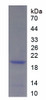 Mouse Recombinant C4 Binding Protein Alpha (C4BPa)