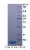 Human Recombinant Interleukin 18 Receptor 1 (IL18R1)