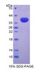Mouse Recombinant Trefoil Factor 3, Intestinal (TFF3)