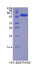 Mouse Recombinant Fatty Acid Transport Protein 5 (FATP5)