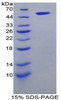 Rat Recombinant Fatty Acid Transport Protein 5 (FATP5)