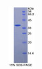 Mouse Recombinant Melanoma Cell Adhesion Molecule (MCAM)