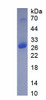 Mouse Recombinant Insulin Like Growth Factor Binding Protein 7 (IGFBP7)