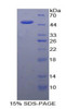 Human Recombinant Interleukin 21 (IL21)