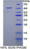 Pig Recombinant Fatty Acid Binding Protein 4, Adipocyte (FABP4)