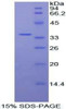 Human Recombinant Protein Kinase B Beta (PKBb)