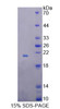 Rat Recombinant B And T-Lymphocyte Attenuator (BTLA)