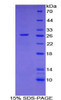 Mouse Recombinant C-Type Lectin Domain Family 13, Member A (CLEC13A)