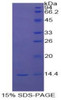 Cattle Recombinant Signal Transducer And Activator Of Transcription 3 (STAT3)