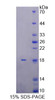 Rat Recombinant Killer Cell Lectin Like Receptor Subfamily K, Member 1 (KLRK1)