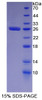 Human Recombinant Minichromosome Maintenance Deficient 2 (MCM2)