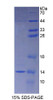 Rat Recombinant S100 Calcium Binding Protein A8 (S100A8)