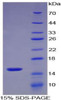 Mouse Recombinant S100 Calcium Binding Protein A9 (S100A9)