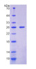 Mouse Recombinant Natural Cytotoxicity Triggering Receptor 1 (NCR1)