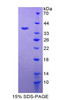 Rat Recombinant Interleukin 6 Receptor (IL6R)