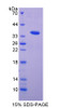 Rat Recombinant Vascular Endothelial Growth Factor Receptor 1 (VEGFR1)