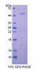 Rabbit Recombinant Complement Component 9 (C9)