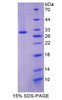 Mouse Recombinant Paxillin (Pax)