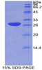 Mouse Recombinant Inhibitory Subunit Of NF Kappa B Beta (IkBb)