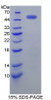 Human Recombinant Epidermal Growth Factor Receptor 2 (EGFR2)