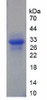 Human Recombinant Xeroderma Pigmentosum, Complementation Group G (XPG)