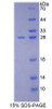 Human Recombinant Cadherin, Heart (CDHH)