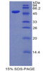 Mouse Recombinant Kallikrein 7 (KLK7)