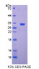 Mouse Recombinant S Antigen (SAG)