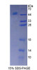 Rat Recombinant Bruton'S Tyrosine Kinase (Btk)