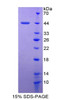 Human Recombinant Monokine Induced By Interferon Gamma (MIg)