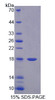 Rat Recombinant Monokine Induced By Interferon Gamma (MIg)