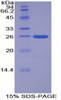 Cattle Recombinant Tissue Factor Pathway Inhibitor 2 (TFPI2)