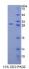 Mouse Recombinant Sperm Protein 17 (Sp17)