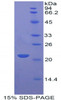 Rat Recombinant Apolipoprotein D (APOD)