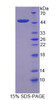 Human Recombinant Complement Component 8g (C8g)