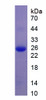 Human Recombinant Apolipoprotein B (APOB)