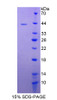 Cattle Recombinant S100 Calcium Binding Protein A2 (S100A2)