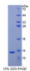 Human Recombinant S100 Calcium Binding Protein A2 (S100A2)